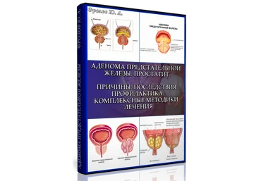 Мини инфопродукт №4 «Аденома предстательной железы. Простатит. Причины. Последствия. Профилактика слив