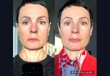 Анна Ахметшина Красота и омоложение 2019 слив