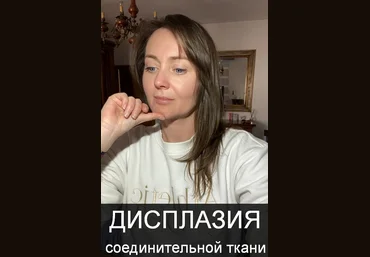 Оксана Терехова Дисплазия соединительной ткани 2023 слив