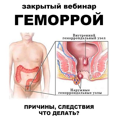 pravda.pro.pisheprom Женя Братишка, Юля Братишка ― Геморрой 2024 слив курса