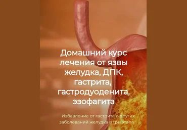 Игорь Кауфман Домашний курс лечения от язвы желудка, ДПК, гастрита 2024 слив