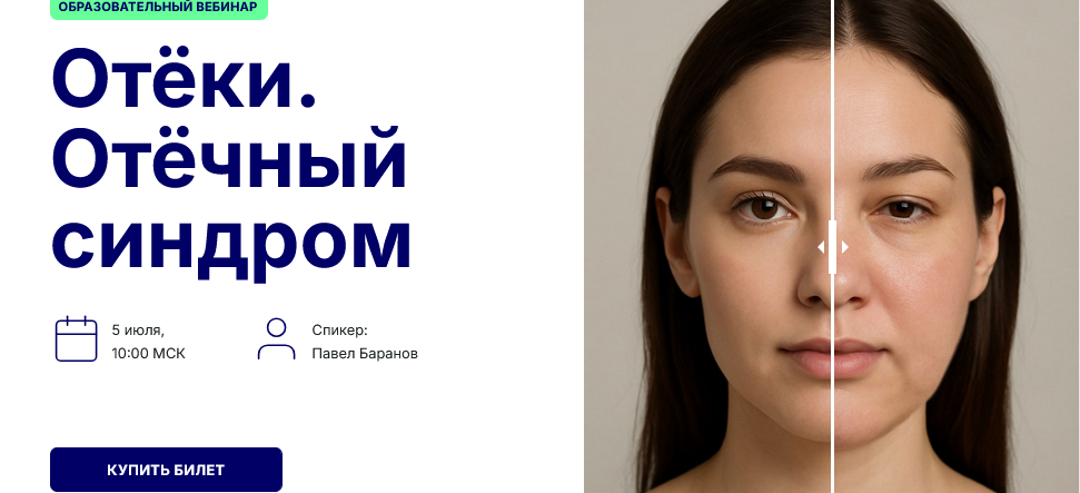 Павел Баранов Отёки. Отёчный синдром 2025 слив курса