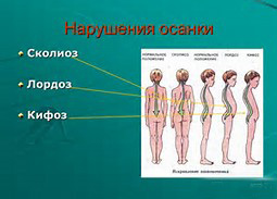 Правильная осанка - Бобкова слив курса