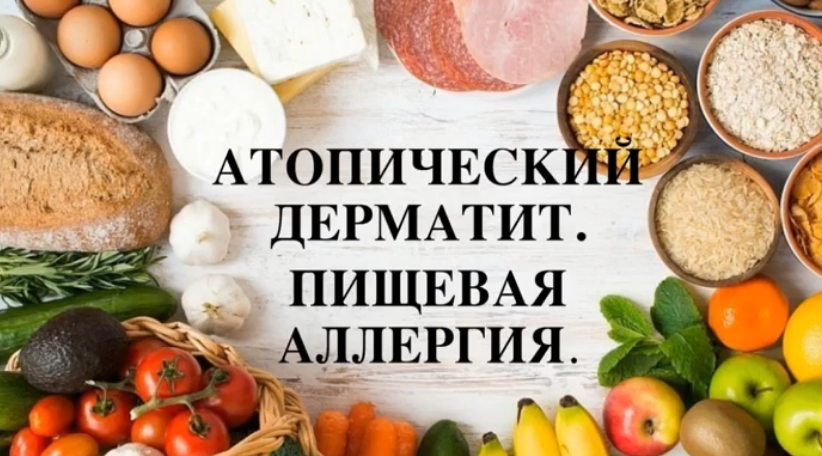 Регина Доктор Атопический дерматит. Пищевая аллергия слив курса