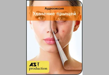 Удаление прыщей - AST production слив