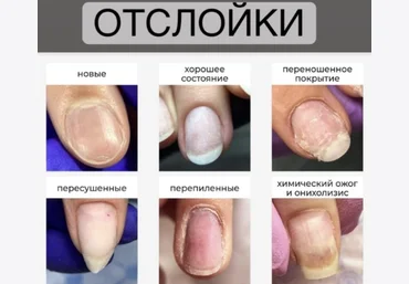 Вельмитина Зайцева Отслойки 2021 слив