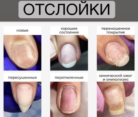 Вельмитина Зайцева Отслойки 2021 слив курса