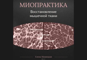 Елена Машицкая Миопрактика 2.0 2022 слив