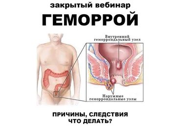 Женя Братишка, Юля Братишка Школа Разумного Покупателя Геморрой 2024 слив