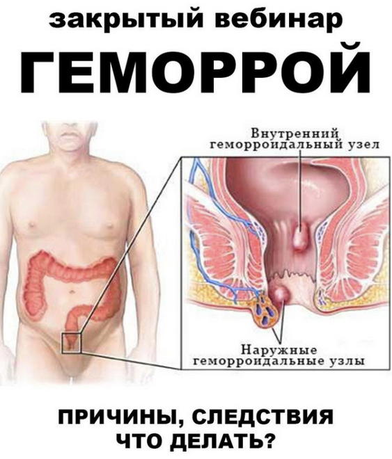 Женя Братишка, Юля Братишка Школа Разумного Покупателя Геморрой 2024 слив курса