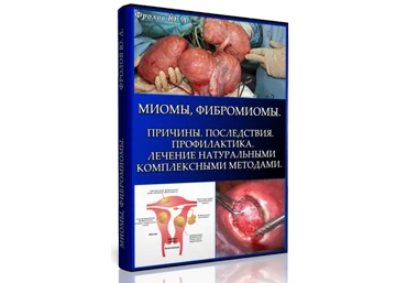 Мини инфопродукт №7. Миомы, Фибромиомы. Причины. Последствия. Профилактика. слив