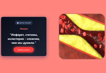Валерий Подрубаев Humberto 2.0 Инфаркт, статины, холестерин - сложнее, чем мы думали 2025 скачать слив