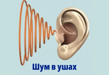 Оверченко К. В. Борисов А. С. Все о шуме в ушах: видеогайд 2023 слив