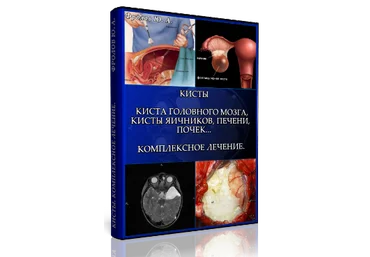 Мини инфопродукт №5. Кисты. Киста головного мозга, Кисты яичников, Печени, почек… Фролов слив
